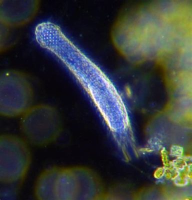  Gastrotrichs Bileşik Gözlü Küçük Canlılarla Deniz Dibinde Hareket Eden Şaşırtıcı Bir Dünyadır!