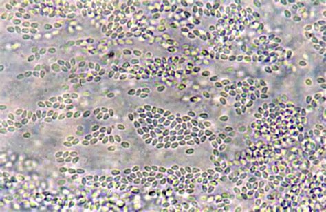  Mikrosporidium: Zararsız Görünen Küçük Bir Parazit mi Yoksa Karmaşık Bir Hayatta Kalma Ustası mı?