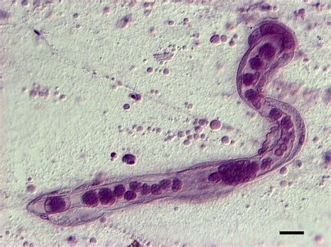 Variomorpha! Unlocking the Mysteries of a Single-Celled Parasite with Complex Life Cycles